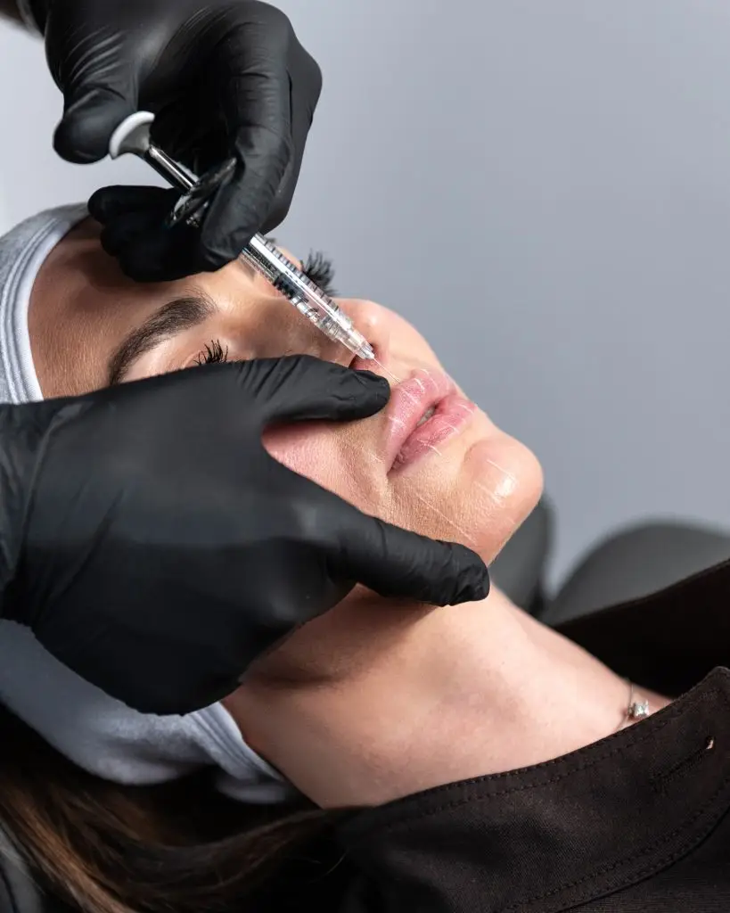 filler labbra